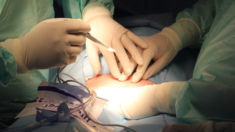 Robotic Surgery in Cancer: Which Cancers Benefit