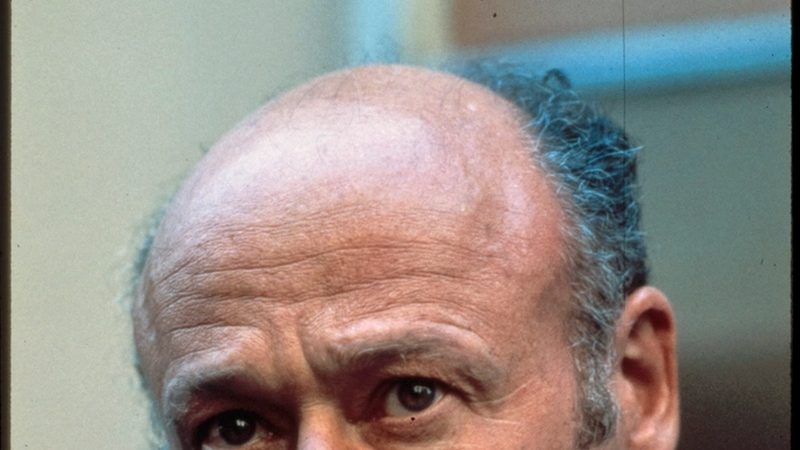Shock Loss: Why Your Transplanted Hair Fell Out