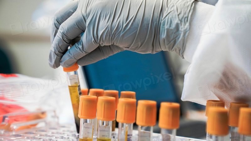 Bone Marrow and Stem Cell Transplant, Step by Step